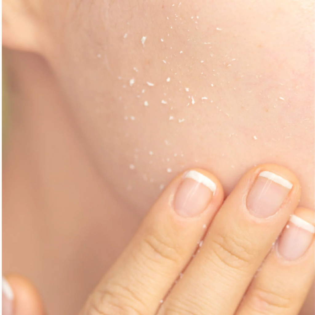 PIME AHA BHA Cleanser 200g x2 | Facial & Body Exfoliator, Gentle Deep Exfoliation & Skin Renewal