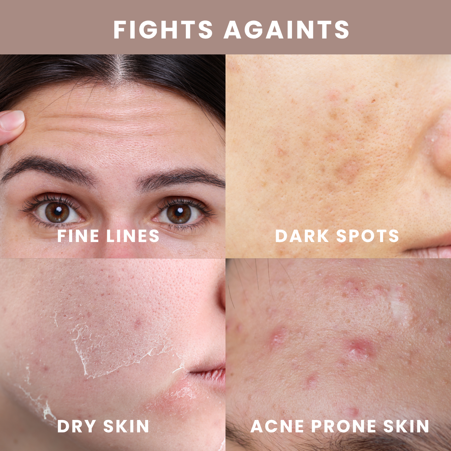 Pime Anti-Aging & Brightening Duo | Day & Night Cream for Acne-Prone Skin, Fights Wrinkles & Dark Spots, 2×50ml