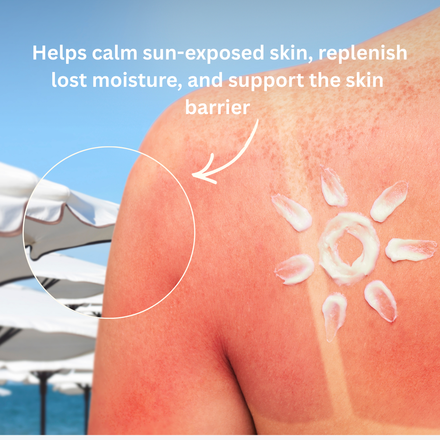 After-Sun Body Cream