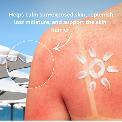 After-Sun Body Cream