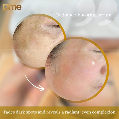Ampoule White Serum for Brightening and Dark Spot Correcting